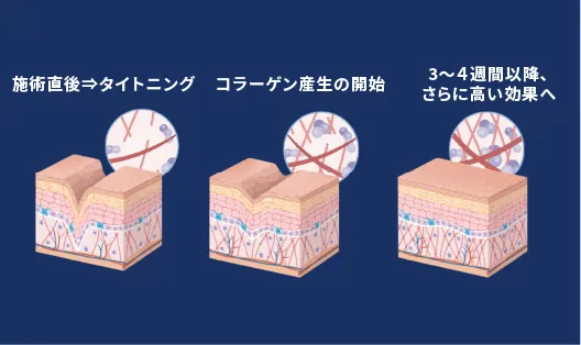 効果の実感まで