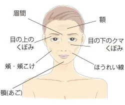 ヒアルロン酸注入が効果的です